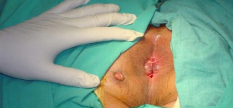 جراحی بیماری های آنورکتال