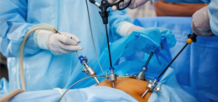 جراحی-کیسه-صفرا-توسط-خانم-دکتر