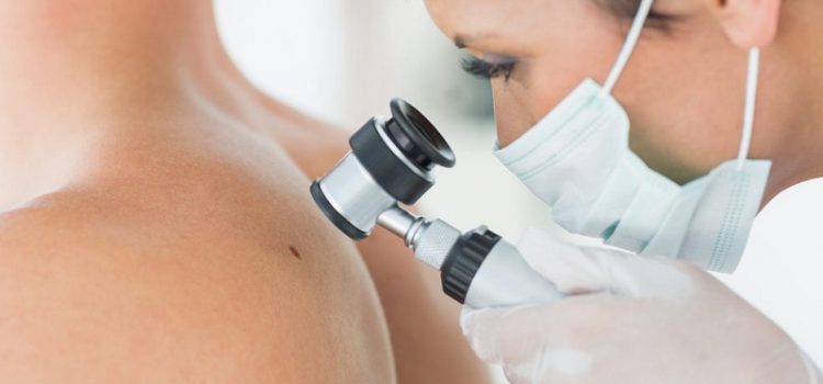 روش های درمان استاندارد برای درمان سرطان پوست درمان استاندارد برای درمان سرطان پوست